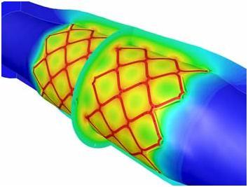 第二部分 Fluent分析前处理过程