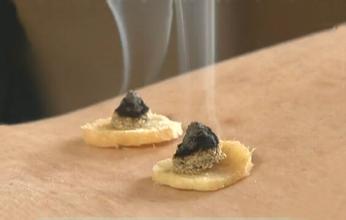 广州中医古法艾灸班