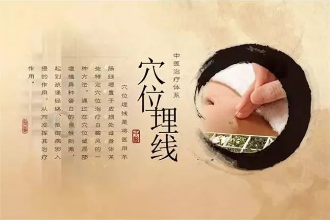 穴位埋线 穴位埋线