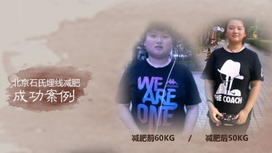 埋线减肥 埋线减肥