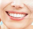 牙齿美容 牙齿美容