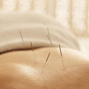 u=3387717487,521766451&fm=26&gp=0