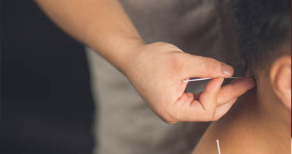 中医针灸 中医针灸