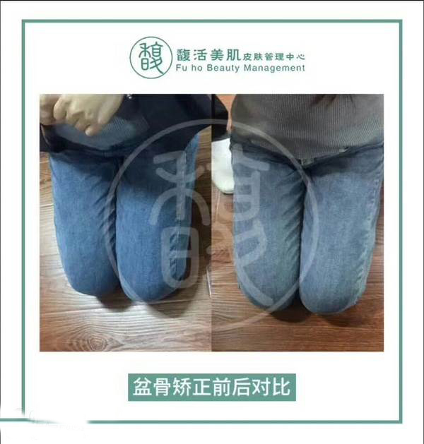 上海馥活美肌特色项目