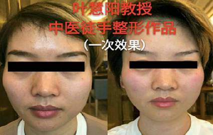 佛山面部精雕培训班