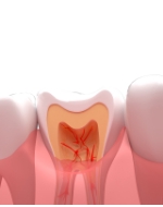 郑州娅婰娜美牙培训 郑州娅婰娜美牙培训