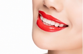 微雅全瓷贴面培训中心