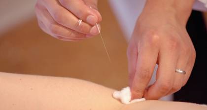 任氏现代针灸埋线学习班 任氏现代针灸埋线学习班