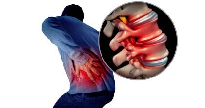 脊柱侧弯学习班 (1)