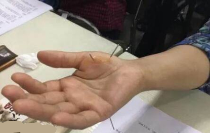 佛山董氏(正经)奇穴针灸临床验案高级班 佛山董氏(正经)奇穴针灸临床验案高级班