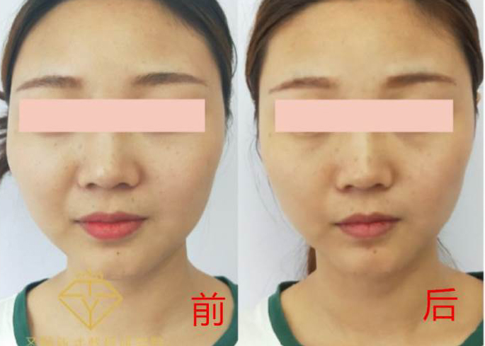 173704328423 173704328423