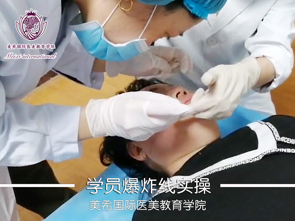 爆炸线实操教学