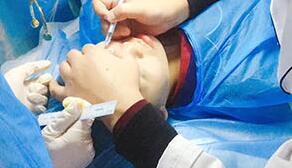 美白针配方与静脉注射 美白针配方与静脉注射