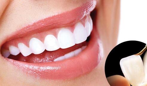 浮雕美牙 浮雕美牙