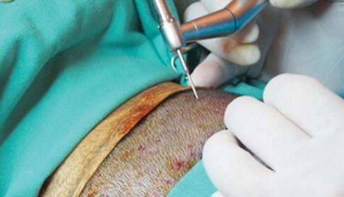 技术原理 技术原理