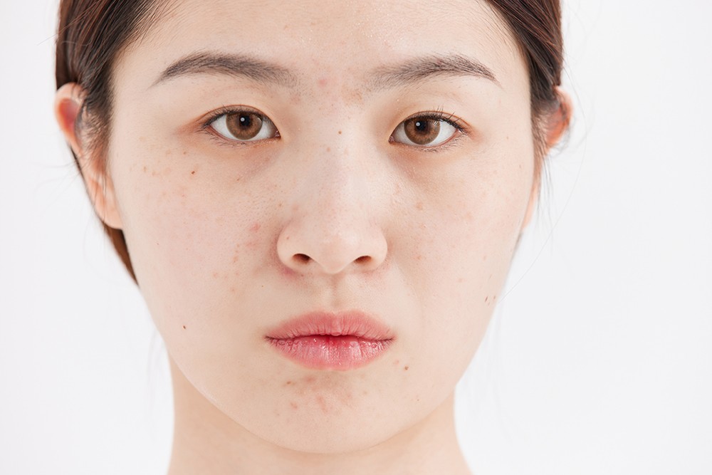 皮肤问题 皮肤问题