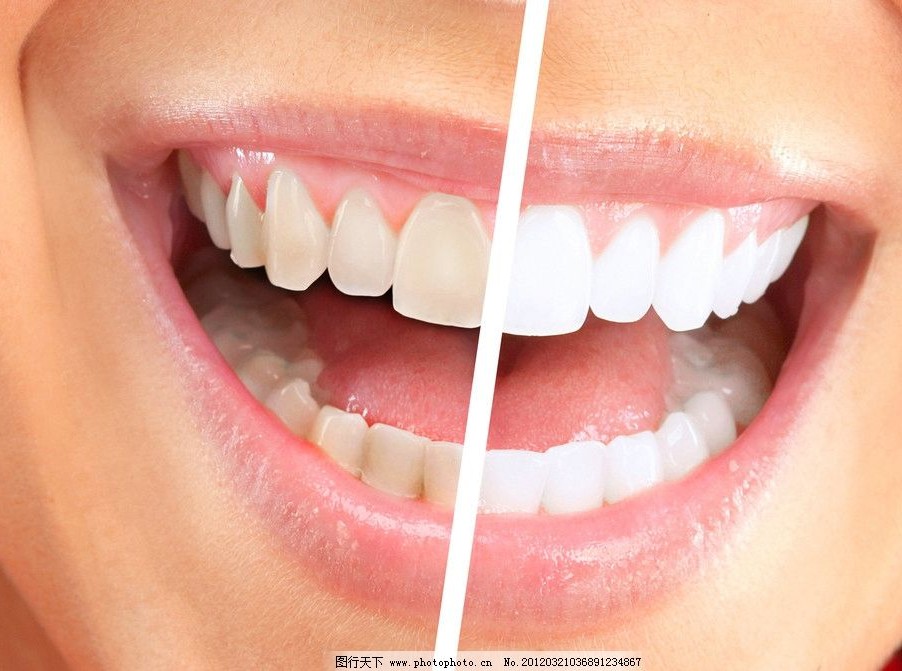 美牙左右对比 美牙左右对比
