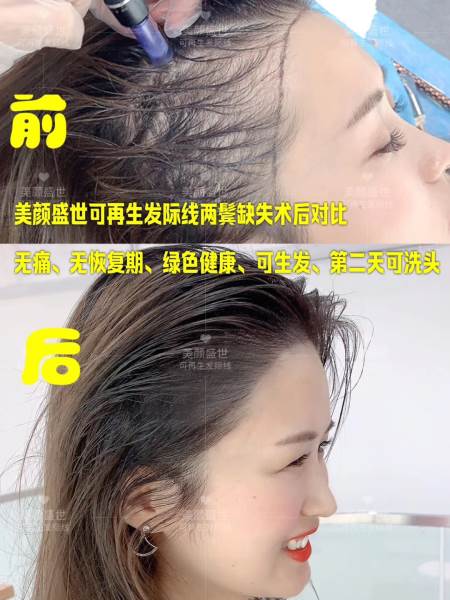 再生发效果展示二