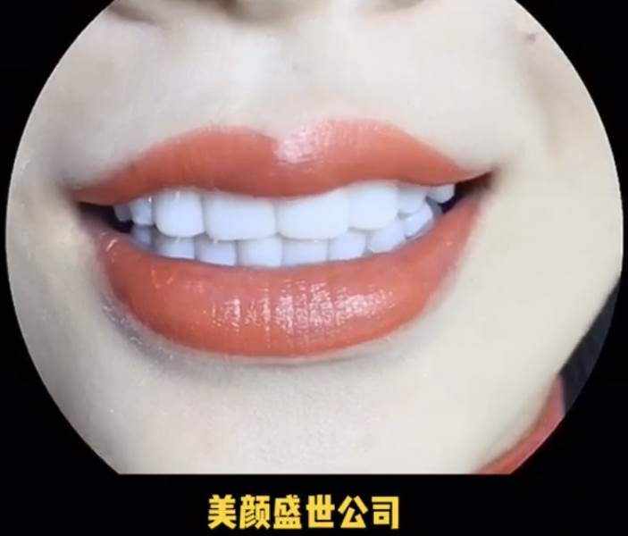 美牙效果展示三