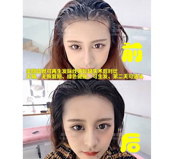 效果前后对比一