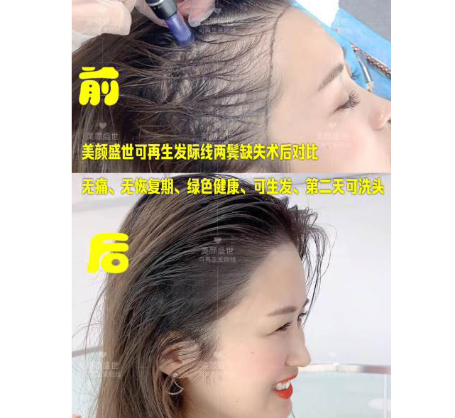 效果前后对比二