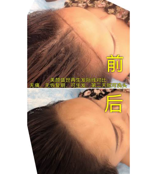 效果前后对比三