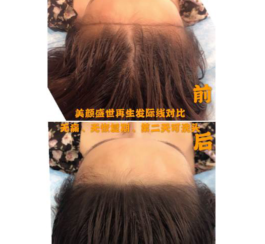 效果前后对比五