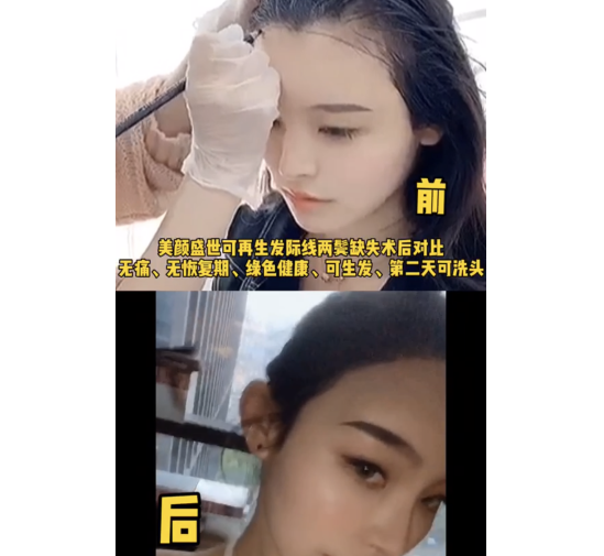 效果前后对比四