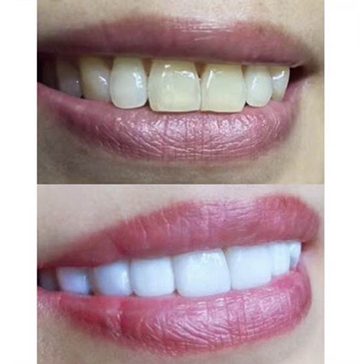 效果前后对比三