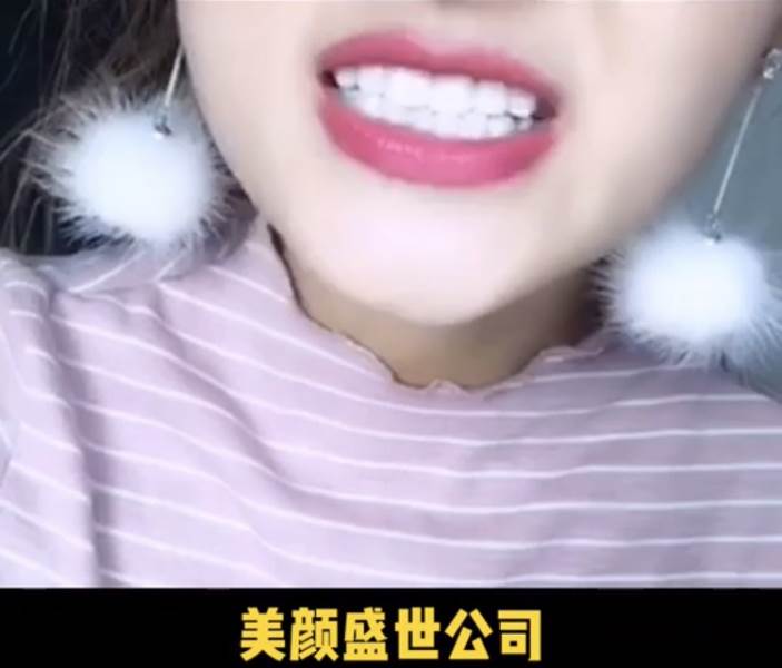 美牙效果对比三