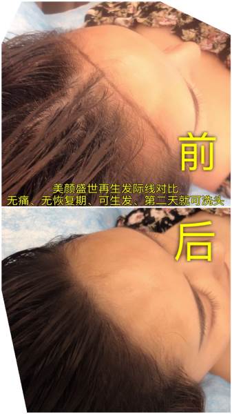 再生发效果对比三