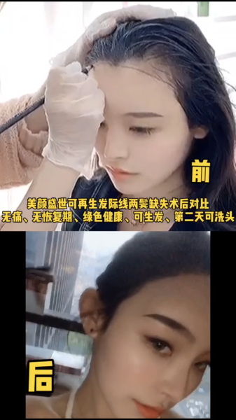 再生发效果对比五