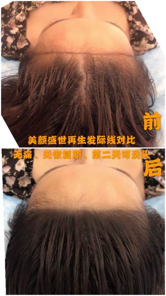 再生发效果对比六