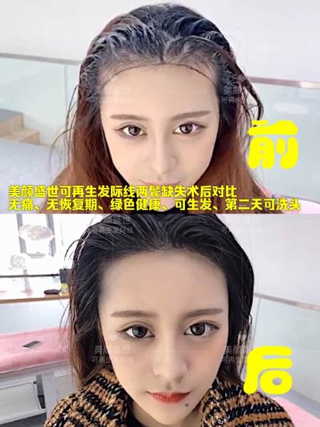 再生发效果对比四