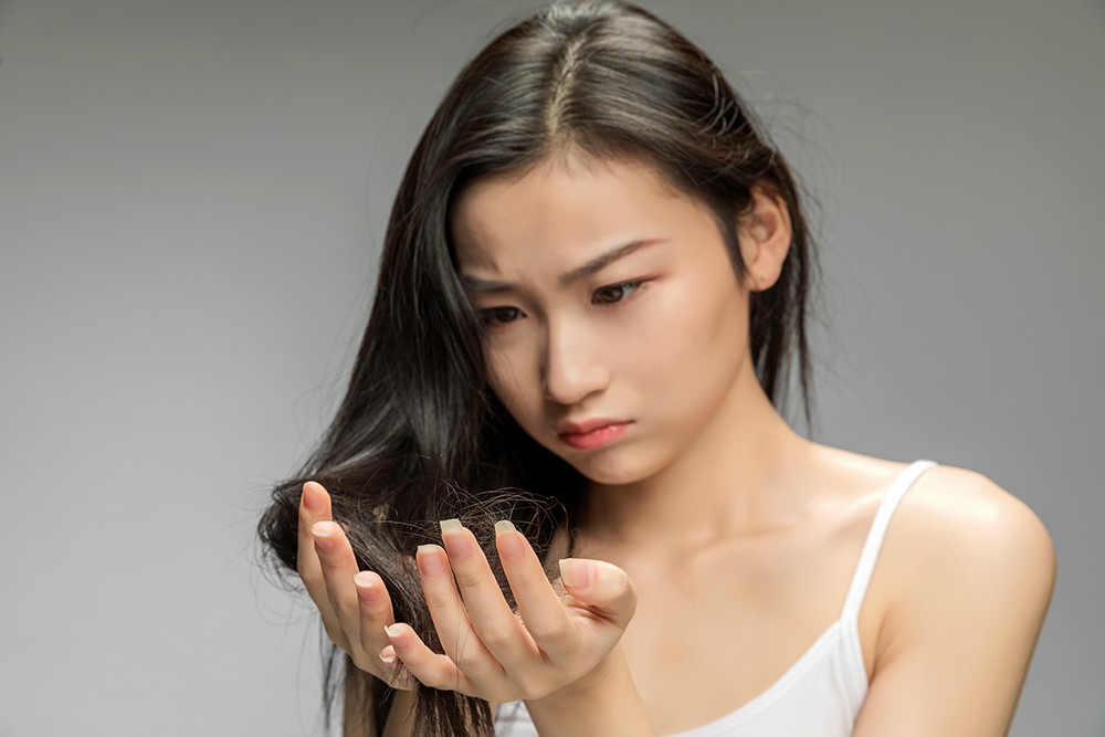 脱发困扰 脱发困扰