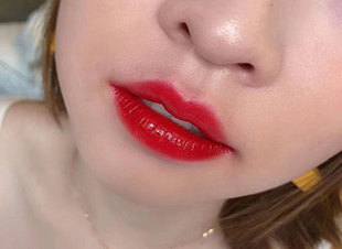 唇部术后注意事项