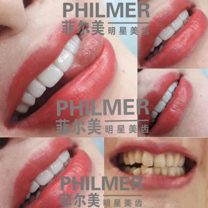 效果展示 效果展示