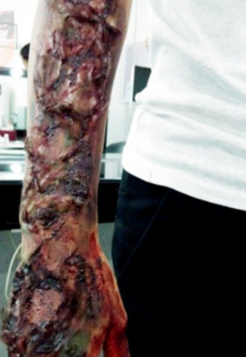 伤效仿真——手臂炸伤 伤效仿真——手臂炸伤