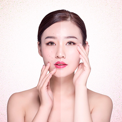 郑州基础祛斑祛痘培训班