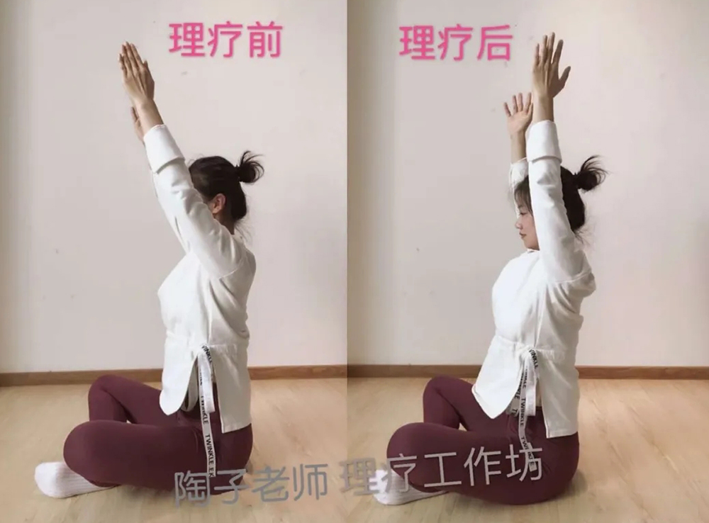 理疗前后对比