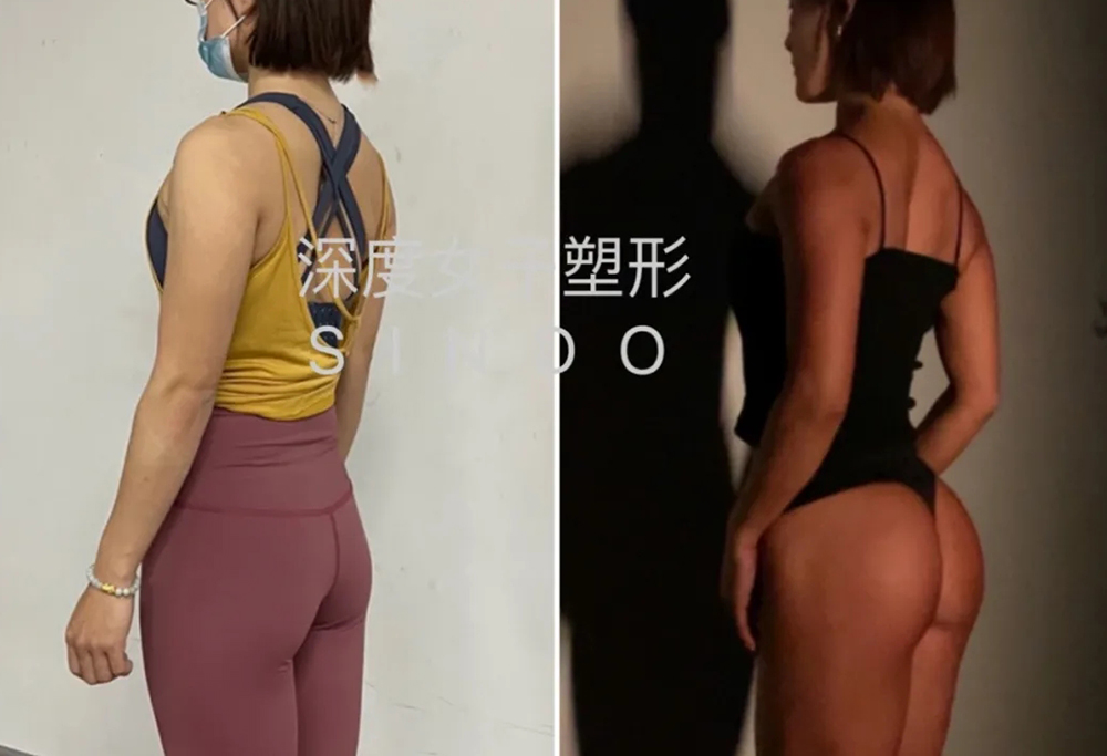 学员塑形前后对比一 学员塑形前后对比一