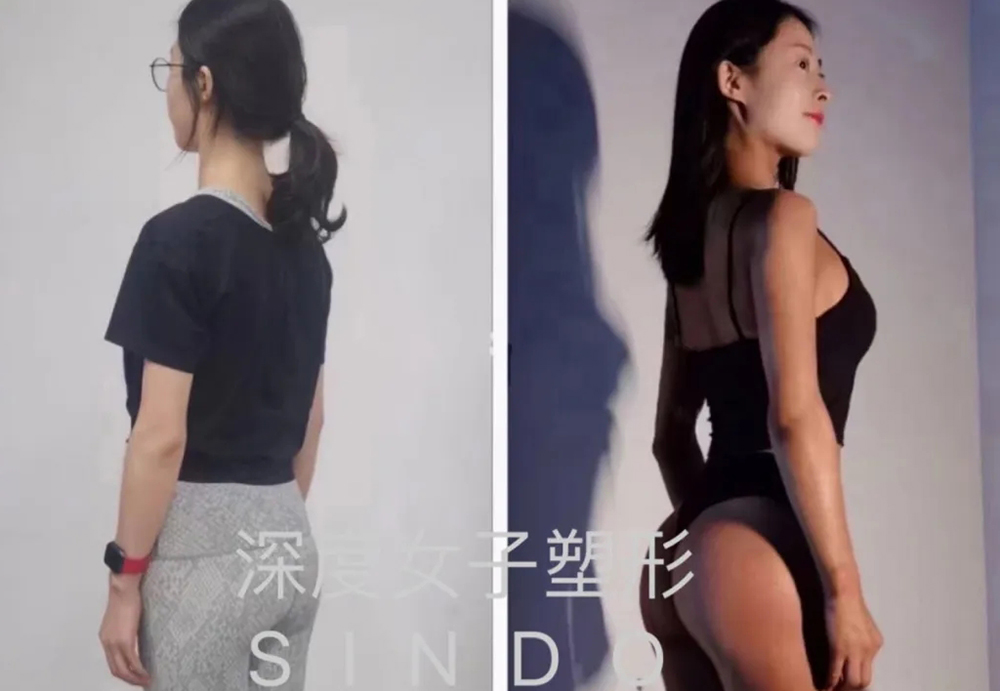 学员塑形前后对比二 学员塑形前后对比二