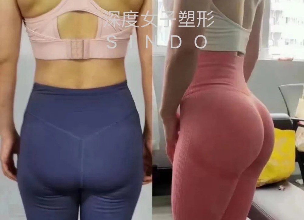 学员塑形前后对比三 学员塑形前后对比三