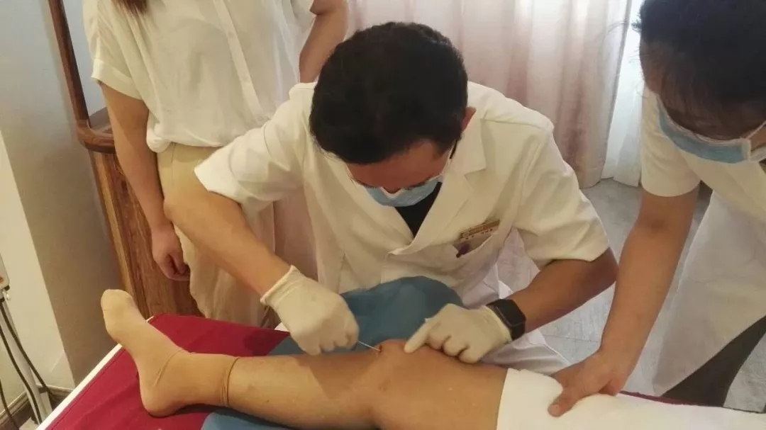 和派圆针治疗膝关节临床优势 和派圆针治疗膝关节临床优势