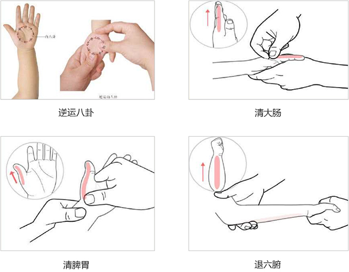 发热——积食发热