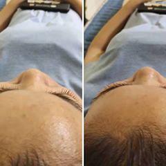 關(guān)于面部瑜伽 關(guān)于面部瑜伽