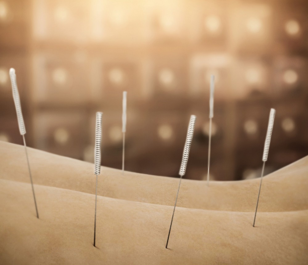 中医针灸