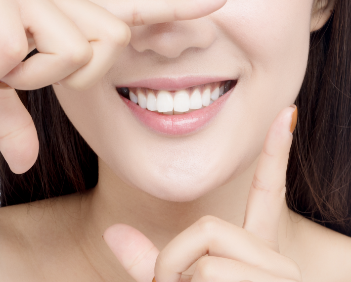 美牙介绍 美牙介绍