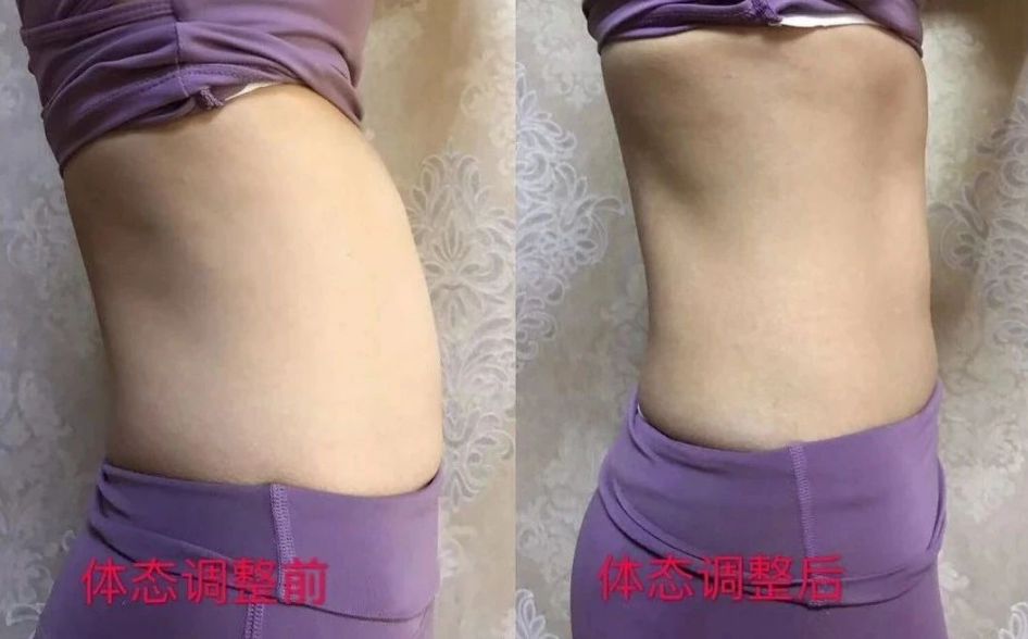 体态调整对比 体态调整对比