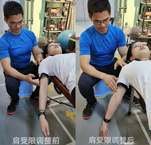 肩受限调整前后 肩受限调整前后